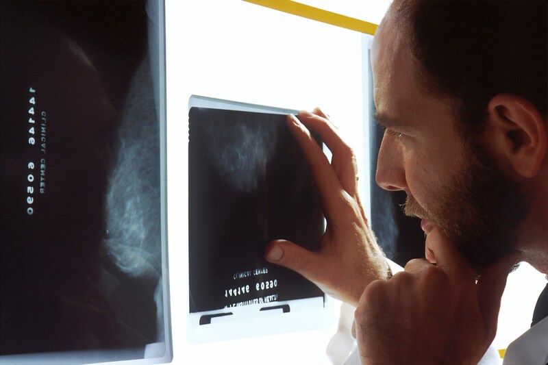 does-medicare-cover-mammograms