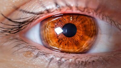 what-type-of-lens-does-medicare-cover-for-cataract-surgery