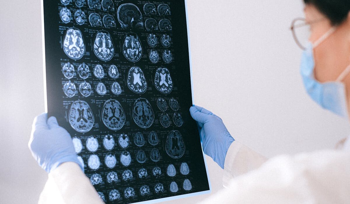 is epilepsy a disability