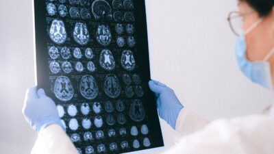 is epilepsy a disability