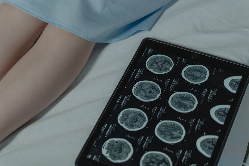 is epilepsy a disability
